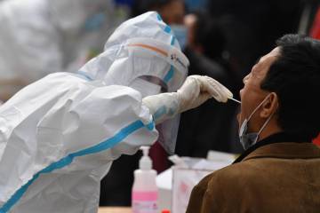 Caso de reinfección de covid genera dudas sobre inmunidad Caso de reinfección de covid genera dudas sobre inmunidad