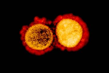 Así se ve el coronavirus a color Así se ve el coronavirus a color