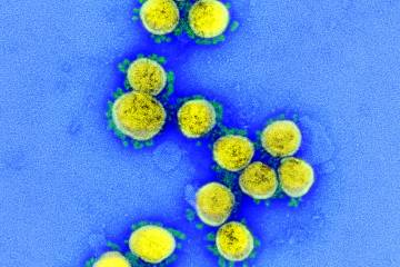 Así se ve el coronavirus a color Así se ve el coronavirus a color