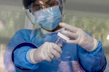 Pacientes con coronavirus tienen falta de vitamina D Pacientes con coronavirus tienen falta de vitamina D