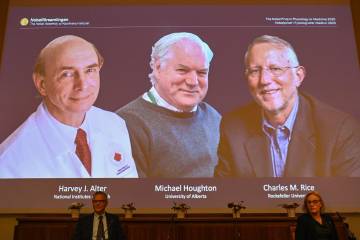 Nobel de Medicina 2020 a tres descubridores del virus de hepatitis C Nobel de Medicina 2020 a tres descubridores del virus de hepatitis C
