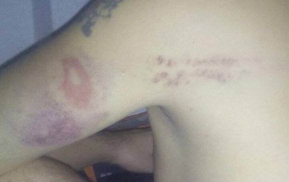Así terminó el detenido luego de la agresión en la estación de Policía de Laureles. FOTO CORTESÍA Así terminó el detenido luego de la agresión en la estación de Policía de Laureles. FOTO CORTESÍA