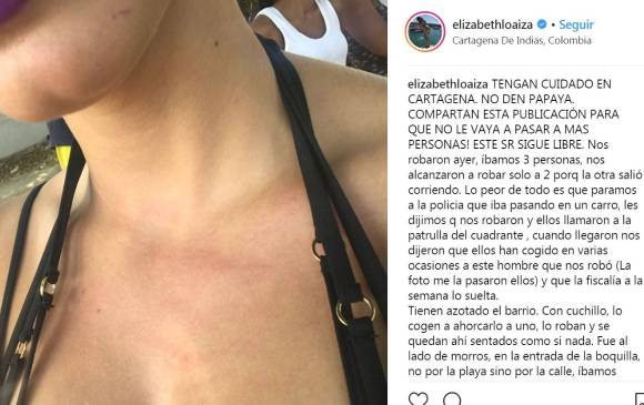 Estas son las marcas que le dejó el supuesto ladrón a la modelo Elizabeth Loaiza. Estas son las marcas que le dejó el supuesto ladrón a la modelo Elizabeth Loaiza.