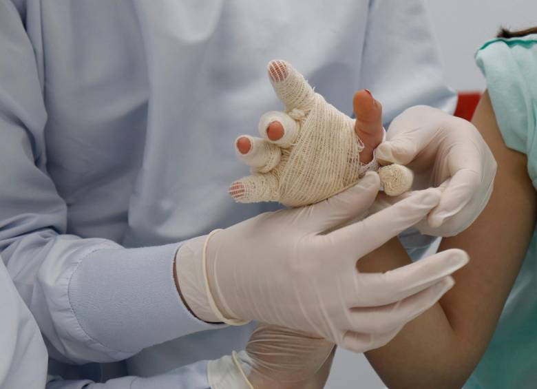 En los días que van de diciembre, el Hospital San Vicente Fundación ha atendido a 45 personas quemadas por líquidos calientes, de las cuales 14 son niños menores de 15 años. FOTO Cortesía
