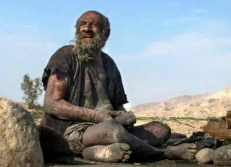 Tras medio siglo sin bañarse, murió el hombre más sucio del mundo