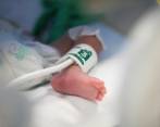 La bebé de 13 meses presentaba quemaduras de segundo grado pues había sido “tratada” inicialmente por un médico ancestral en Vigía del Fuerte. FOTO: Camilo Suárez.