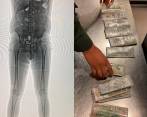 Con la revisión por body scan se le encontró a un hombre miles de dólares entre su ropa interior. FOTO: CORTESÍA