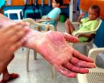 Antioquia es el segundo departamento en el que más personas quemadas se han registrado en esta temporada. FOTO: EL COLOMBIANO 