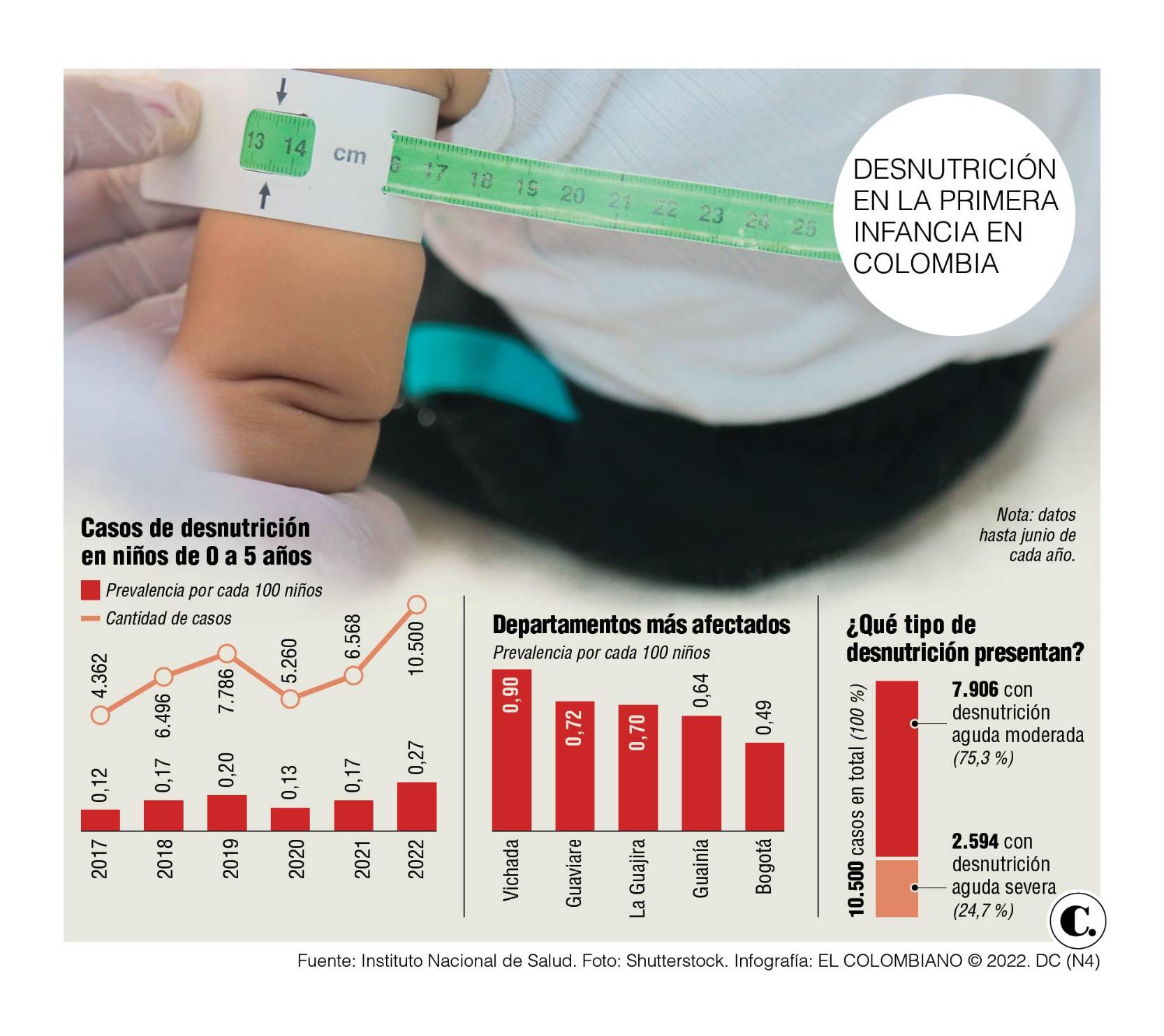 Casos de desnutrición en primera infancia son los más altos de los ...