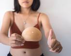 Los implantes mamarios pueden causar la enfermedad de Asia. Le contamos por qué algunas mujeres se someten a la explantación de ellos. 
