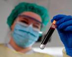 Radka Argirova fue una de las primeras científicas búlgaras en estudiar los virus, y fue quien introdujo el VIH a su país para investigación en medio del régimen comunista. Foto: Getty. 
