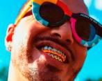 J Balvin, al igual Beyoncé, Rihanna y Roslaía llevaron las joyas a los dientes. FOTO Cortesía
