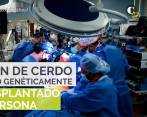 El corazón de un cerdo fue trasplantado con éxito a un humano