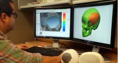 Innmetec podrá distribuir prótesis de articulación temporomandibular y un implante para reemplazo vertebral. Personas con afectaciones en esa parte del cuerpo podrán usarlas. FOTO Cortesía eafit