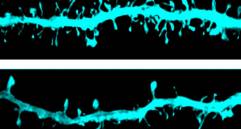 Imagen microscópica de las espinas dendríticas, la zona de la neurona donde se produce la sinapsis. Foto: Sinc-Cima Universidad de Navarra