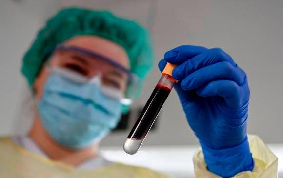 Radka Argirova fue una de las primeras científicas búlgaras en estudiar los virus, y fue quien introdujo el VIH a su país para investigación en medio del régimen comunista. Foto: Getty. 