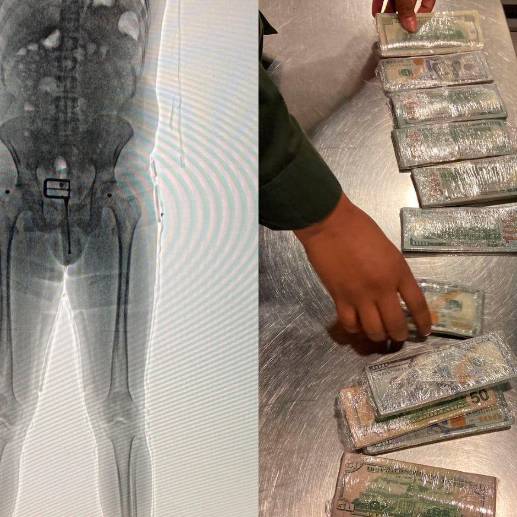 Con la revisión por body scan se le encontró a un hombre miles de dólares entre su ropa interior. FOTO: CORTESÍA