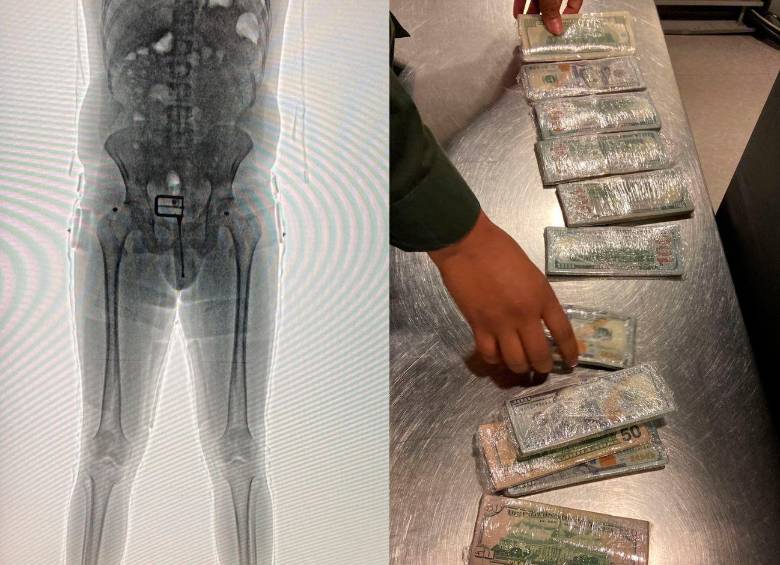 Con la revisión por body scan se le encontró a un hombre miles de dólares entre su ropa interior. FOTO: CORTESÍA