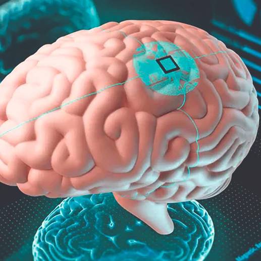 Los chips que propone Elon Musk se implantarán con cirugía robótica. FOTO: SSTOCK