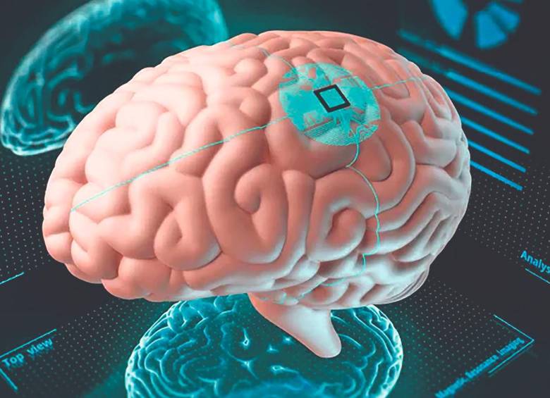 Los chips que propone Elon Musk se implantarán con cirugía robótica. FOTO: SSTOCK