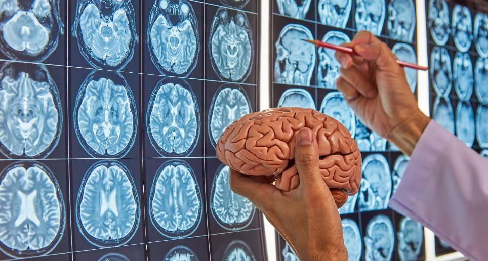 El hemisferio cerebral derecho va ligado a la creatividad y el izquierdo a lógica ¿Es mito?