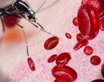 Imagen para ilustrar ña trasmisión de la malaria. ILUSTRACIÓN Esteban París Londoño