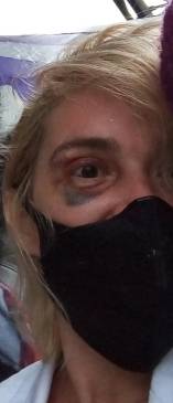 Marilú denuncia que su agresor labora como conductor para un concejal de Medellín. Publicamos la imagen con su autorización.