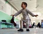 Ahmad Sayed Rahman sufrió las consecuencias de la guerra desde los 8 meses de edad. FOTO: AFP