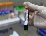 Casi un millón de personas mueren cada año por causas relacionadas con el VIH, a lo que hay que añadir la preocupación creciente por una nueva forma del virus resistente a los medicamentos. Foto Archivo: Robinson Sáenz