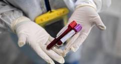 Solo existe un número limitado de pruebas de detección para unos pocos tipos de cáncer. Foto: AFP