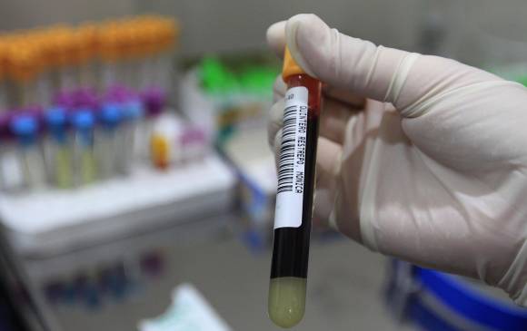 La principal causa de contagio del VIH es la falta de protección. FOTO: Robinson Sáenz