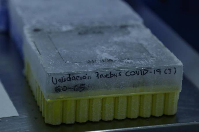 En el Instituto Distrital de Ciencia, Biotecnología e Innovación en Salud (IDCBIS) se llevan a cabo los estudios del uso de plasma de convalecientes para el tratamiento de pacientes con covid-19. FOTO COLPRESA