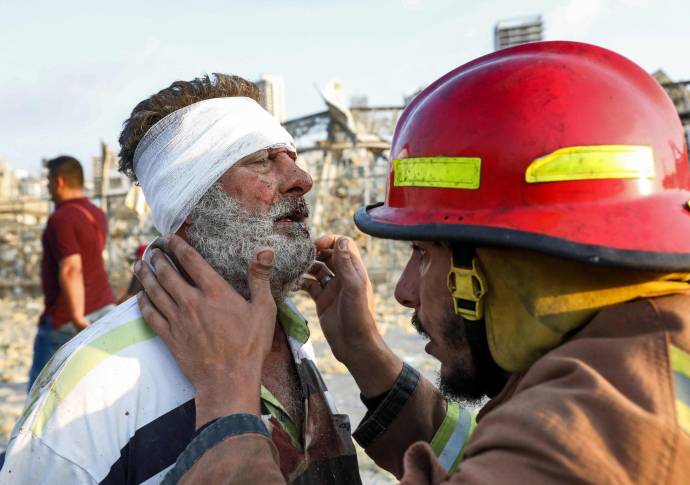 Un bombero controla a un hombre herido cerca de la escena de una explosión en Beirut. El ministro de Sanidad, Hamad Hasan, anunció que hay “muchos heridos y cuantiosos daños materiales”. Foto: AFP