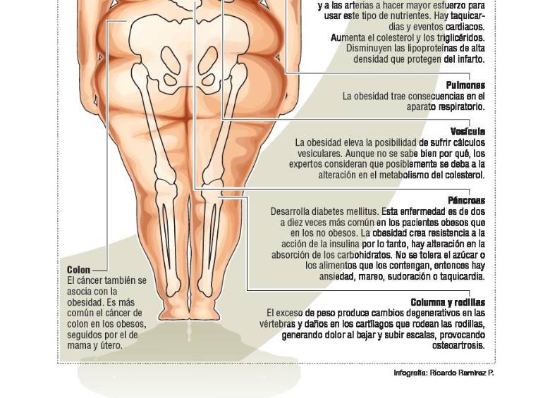 Es prioridad bajar de peso cuando hay exceso de grasa. Eso puede causar otras enfermedades crónicas. Consulte siempre con el nutricionista Foto: El Colombiano