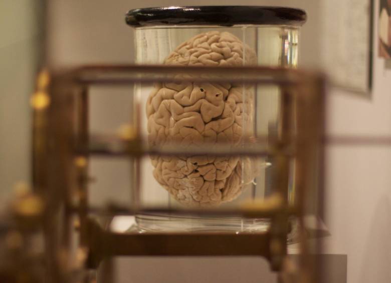 Los científicos utilizaron bombas, calefactores y bolsas de sangre artificial para restaurar la circulación de los cerebros. FOTO Pxhere
