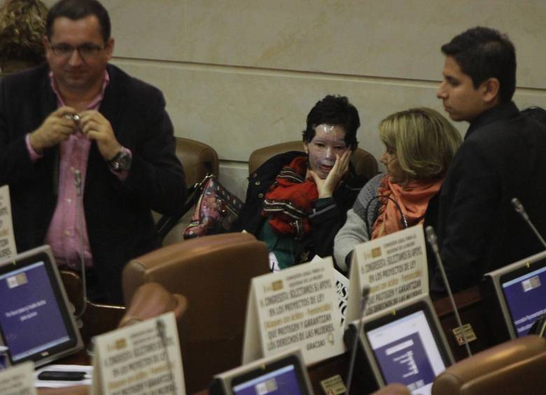 Natalia Ponce pide que proyecto de ley sobre ataques con ácido no sea